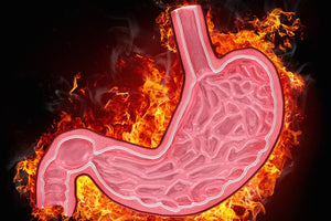 The Truth About Heartburn and GERD